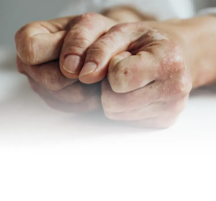 Desktop disease specific banner GEP v3 2x