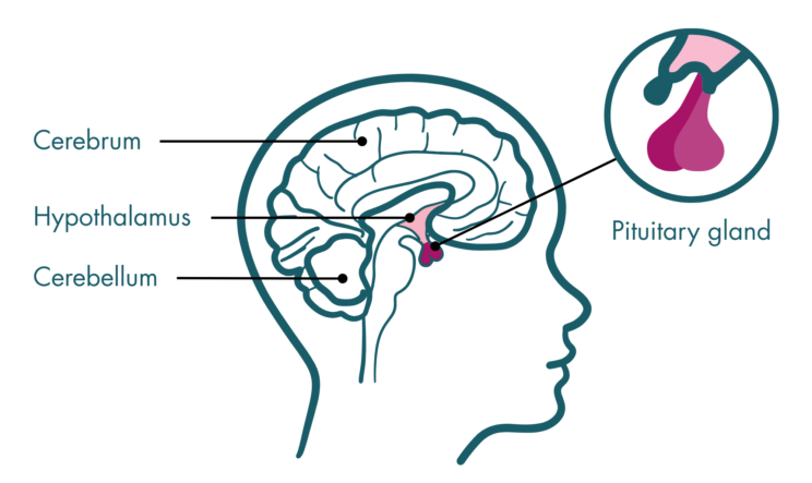 Image of a side view of a person’s head and brain. Arrows point to the cerebrum, hypothalamus, and cerebellum. Another arrow points to the pituitary gland and features a zoomed-in view of the pituitary gland.