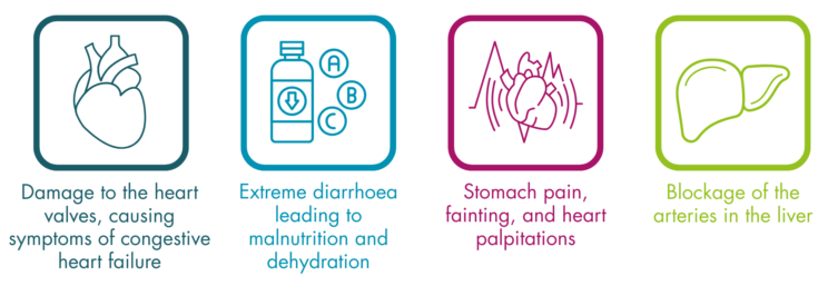 Infographic list of four possible problems related to carcinoid syndrome. Damage to the heart valves, causing symptoms of congestive heart failure. Extreme diarrhoea leading to malnutrition and dehydration. Stomach pain, fainting, and heart palpitations. Blockage of the arteries in the liver.