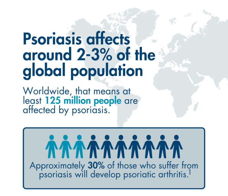 Infographic summarising epidemiology of psoriasis, which affects 2-3% of the global population (at least 125 million people). Below, a text box: “approximately 30% of those who suffer from psoriasis will develop psoriatic arthritis”, which is represented by a graphic with 3 out of 10 figures highlighted.