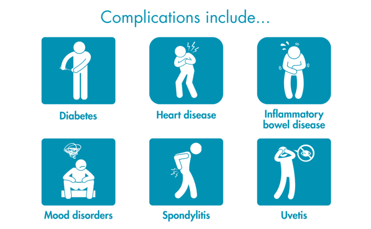 Infographic listing complications with related icons: diabetes (stick man injecting insulin), heart disease (stick man clutching chest), inflammatory bowel disease (stick man clutching stomach), mood disorders (stick man looking sad), spondylitis (stick man holding back), and uvetis (stick man covering eyes