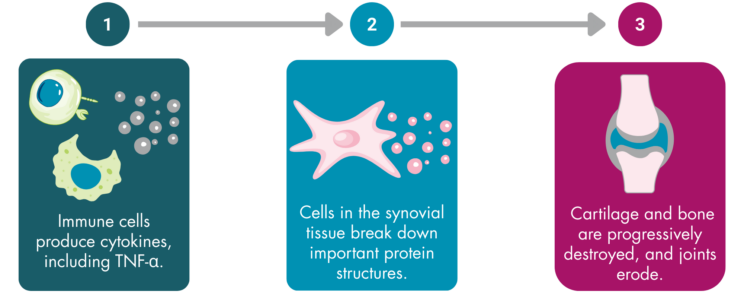“The process of inflammation. Step 1. Immune cells produce cytokines, including TNF-alpha. Step 2. Cells in the synovial tissue break down important protein structures. Step 3. Cartilage and bone are progressively destroyed, and joints erode.”