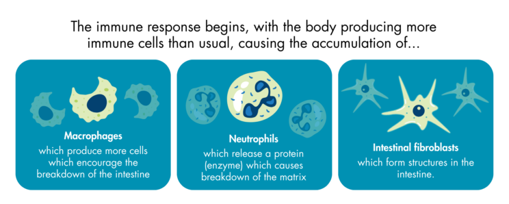 A diagram with schematic images of three immune cells - macrophages, neutrophils and intestinal fibroblasts. The diagram states that the immune response begins with the body producing more immune cells than usual, causing the accumulation of macrophages (which produce more cells which encourage the breakdown of the intestine), neutrophils (which release a protein (enzyme) which causes breakdown of the matrix) and intestinal fibroblasts (which form structures in the intestine).