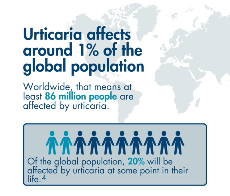 A graphic stating “Urticaria affects around 1% of the global population. Worldwide, that means at least 86 million people are affected by urticaria. Of the global population, 20% will be affected by urticaria at some point in their life (reference 4).