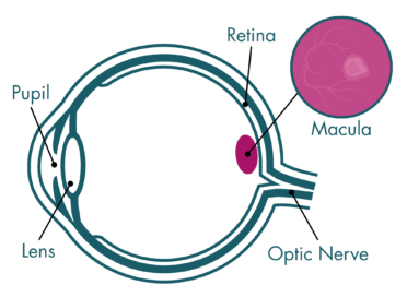 Line diagram of the cross-section of an eye. The pupil is a gap in the front of the eye, the lens is an oval shaped section behind the pupil, the retina is the inner layer of the back of the eye, with a purple patch on it which is labelled the macula, and the optic nerve is a line leaving the back of the eye.